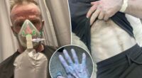 Man hospitalized after turning completely blue â leading to bizarre bedroom discovery